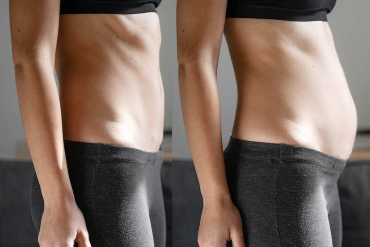 How long does diastasis recti take to improve Greenford?