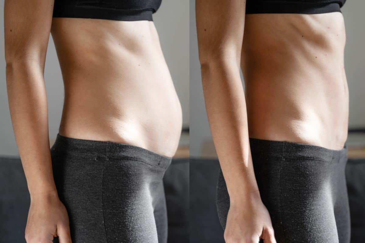 Post-Pregnancy: What Happens to Your Abdominal Muscles After Birth Greenford