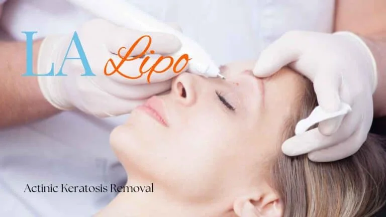 Woman receiving Actinic Keratosis Removal Treatment Greenford