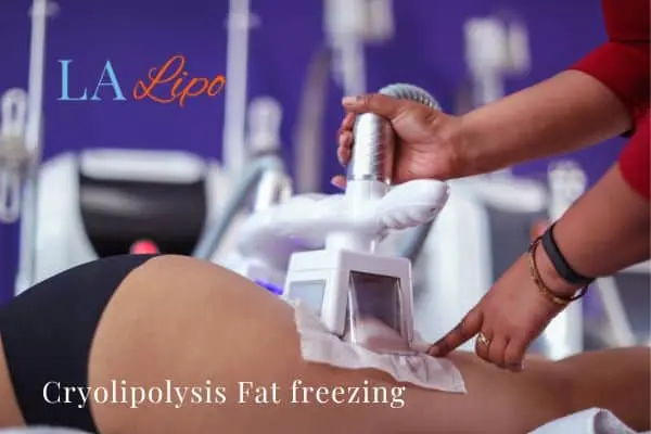 women getting fat freezing Greenford