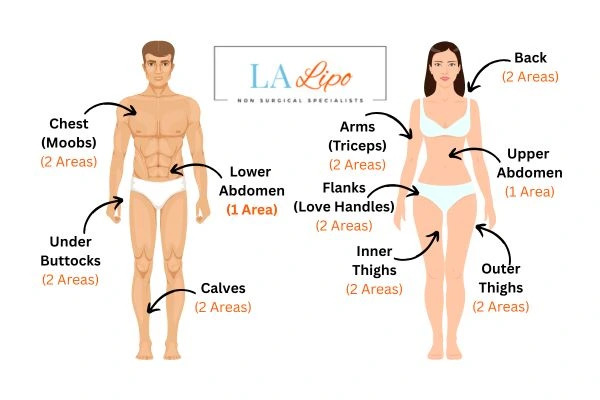 LA LIPO Cryolipolysis Areas Greenford