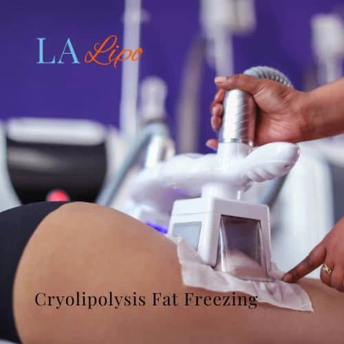 fat freezing - Cryolipolysis Greenford