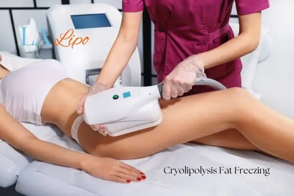 Woman receiving coolsculpting Greenford treatment on her thighs