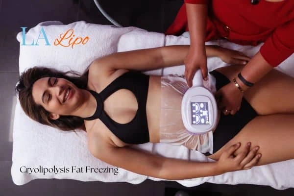 woman getting cryolipolysis Greenford