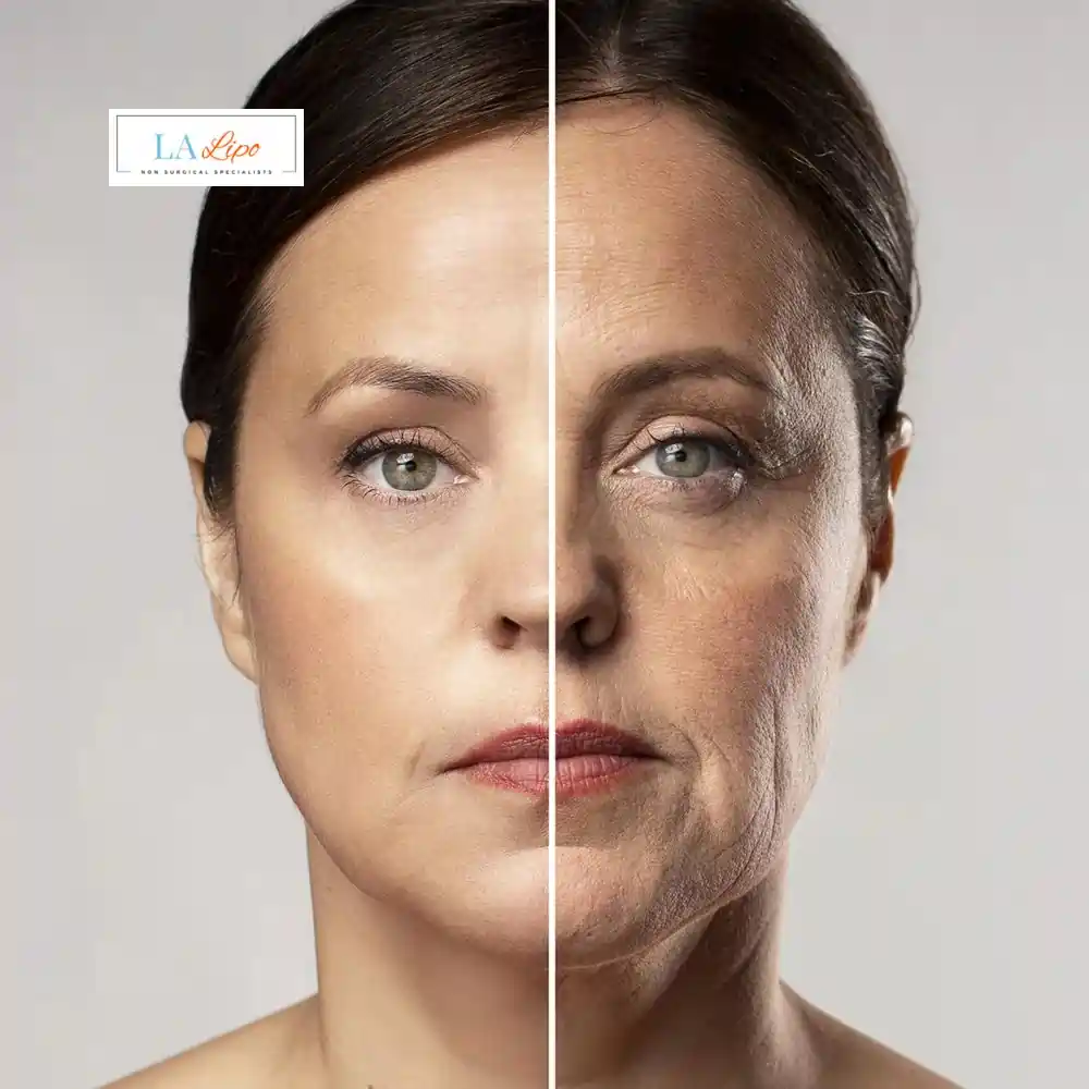 How Can You Tell If Non-Surgical Skin Tightening Is Right for You Greenford?