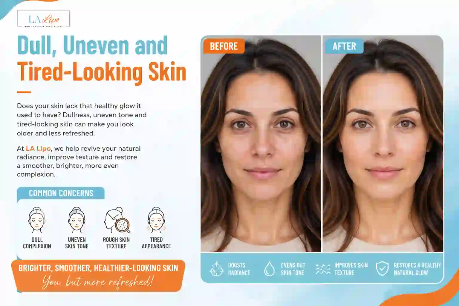 Sign #5: Dull, Uneven and Tired-Looking Skin Greenford