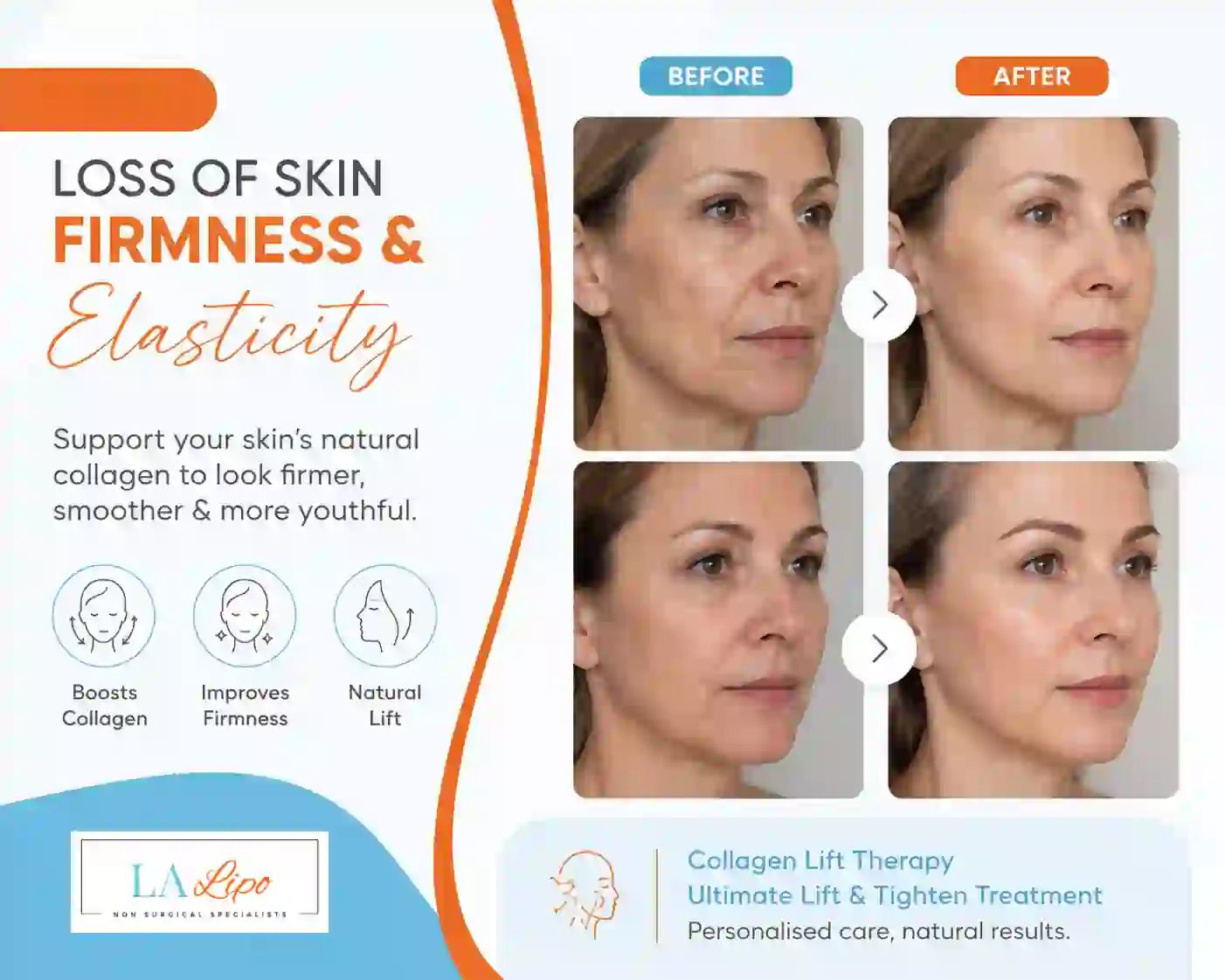Sign #7: Loss of Skin Firmness and Elasticity Greenford