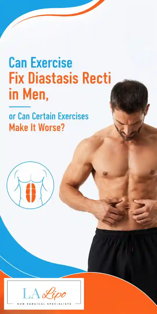 Can Exercise Fix Diastasis Recti in Men, or Can Certain Exercises Make It Worse Greenford?