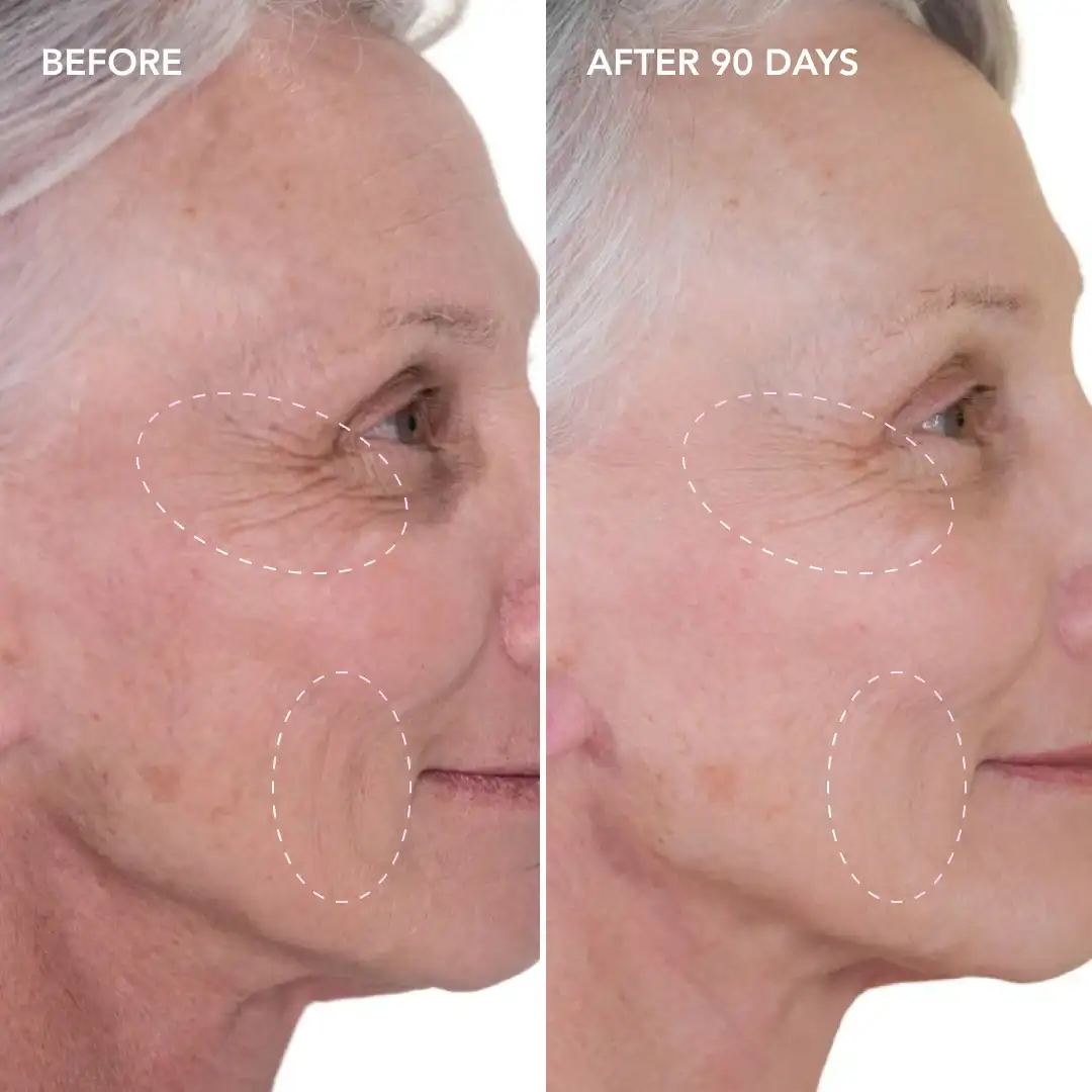 When will you see results Greenford